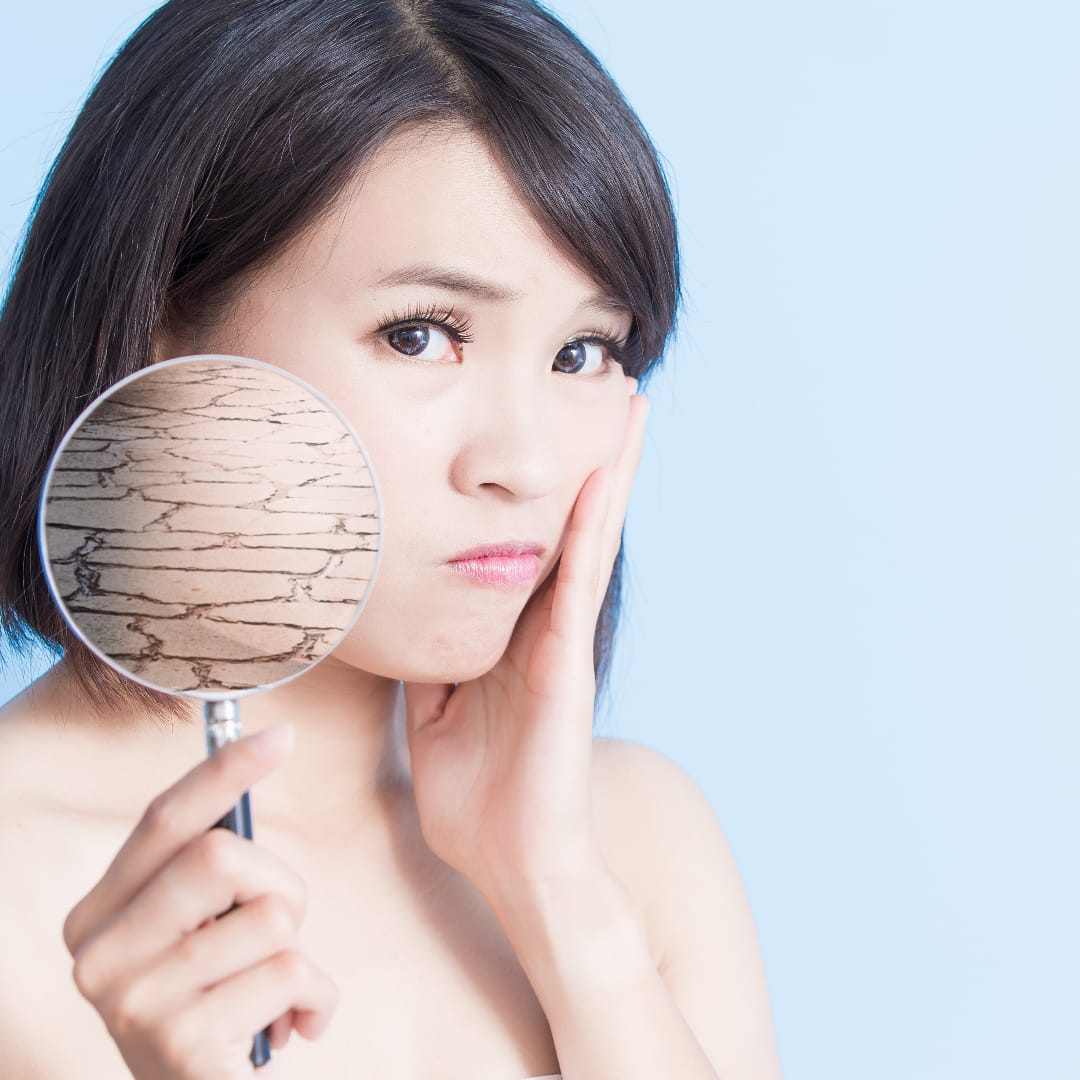 Mis productos me pueden provocar brotes - Chok Chok Beauty