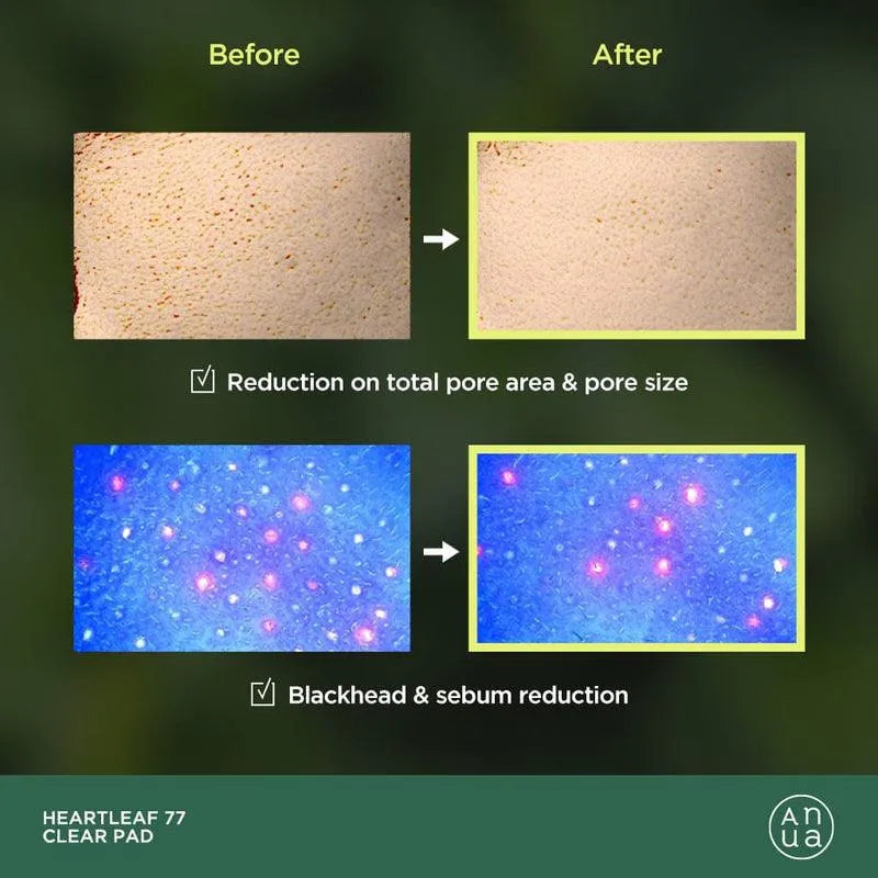 HEARTLEAF 77% TONER PAD - Chok Chok Beauty