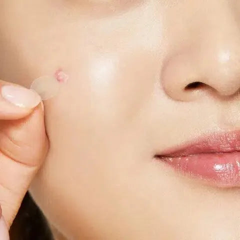 Clear Fit Master Patch - Chok Chok Beauty